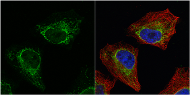 Anti-Aconitase 2 antibody [C1C3] used in Immunocytochemistry/ Immunofluorescence (ICC/IF). GTX109736