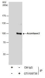 Anti-Aconitase 2 antibody [C1C3] used in Immunoprecipitation (IP). GTX109736