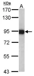 Anti-Aconitase 2 antibody [C1C3] used in Western Blot (WB). GTX109736
