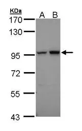 Anti-Aconitase 2 antibody [C1C3] used in Western Blot (WB). GTX109736