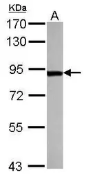 Anti-ThrRS antibody used in Western Blot (WB). GTX109743