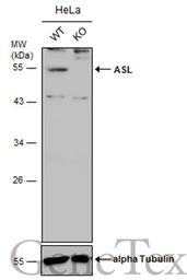 Anti-ASL antibody used in Western Blot (WB). GTX109750