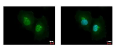 Anti-ASL antibody used in Immunocytochemistry/ Immunofluorescence (ICC/IF). GTX109750