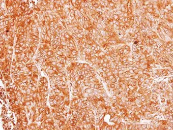 Anti-ASL antibody used in IHC (Paraffin sections) (IHC-P). GTX109750