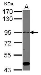 Anti-ATP2C1 antibody [C1C2], Internal used in Western Blot (WB). GTX109770
