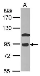 Anti-COG7 antibody used in Western Blot (WB). GTX109776
