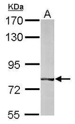 Anti-BBS7 antibody [N3C2], Internal used in Western Blot (WB). GTX109780