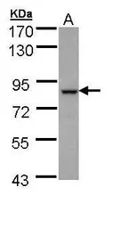 Anti-BBS7 antibody [N3C2], Internal used in Western Blot (WB). GTX109780
