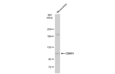 Anti-CDH11 antibody used in Western Blot (WB). GTX109792