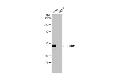 Anti-CDH11 antibody used in Western Blot (WB). GTX109792