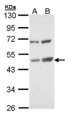 Anti-TSPYL1 antibody used in Western Blot (WB). GTX109809