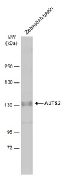 Anti-AUTS2 antibody [N3C1], Internal used in Western Blot (WB). GTX109811