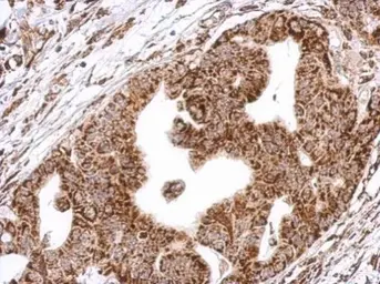 Anti-HCS antibody used in IHC (Paraffin sections) (IHC-P). GTX109815