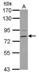 Anti-HCS antibody used in Western Blot (WB). GTX109815