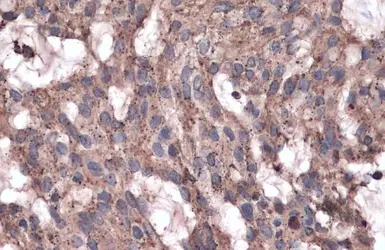 Anti-LYAG antibody [C2C3], C-term used in IHC (Paraffin sections) (IHC-P). GTX109821