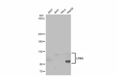 Anti-LYAG antibody [C2C3], C-term used in Western Blot (WB). GTX109821