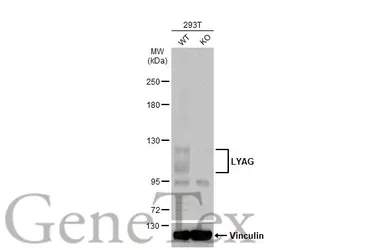 Anti-LYAG antibody [C2C3], C-term used in Western Blot (WB). GTX109821