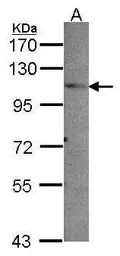 Anti-PEX6 antibody used in Western Blot (WB). GTX109826