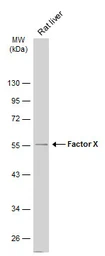 Anti-Factor X antibody used in Western Blot (WB). GTX109830