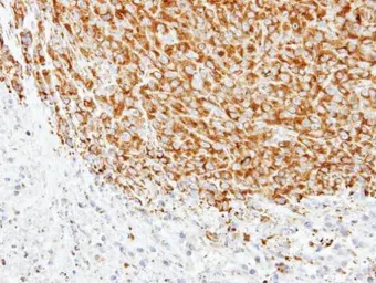 Anti-alpha Tubulin 1A antibody used in IHC (Paraffin sections) (IHC-P). GTX109832