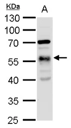 Anti-alpha Tubulin 1A antibody used in Western Blot (WB). GTX109832
