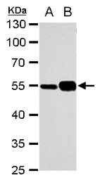 Anti-alpha Tubulin 1A antibody used in Western Blot (WB). GTX109832