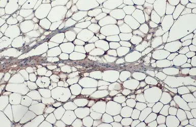 Anti-Fatty Acid Synthase antibody [N1], N-term used in IHC (Paraffin sections) (IHC-P). GTX109833