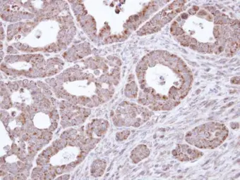Anti-B3GALTL antibody used in IHC (Paraffin sections) (IHC-P). GTX109849
