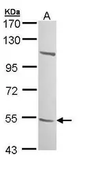 Anti-B3GALTL antibody used in Western Blot (WB). GTX109849