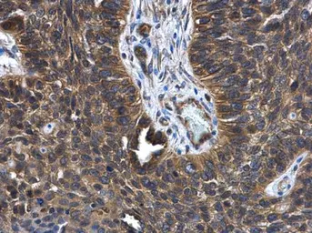 Anti-FGD4 antibody [N1N3] used in IHC (Paraffin sections) (IHC-P). GTX109859