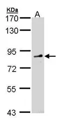 Anti-FGD4 antibody [N1N3] used in Western Blot (WB). GTX109859