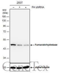Anti-Fumarate hydratase antibody used in Western Blot (WB). GTX109877