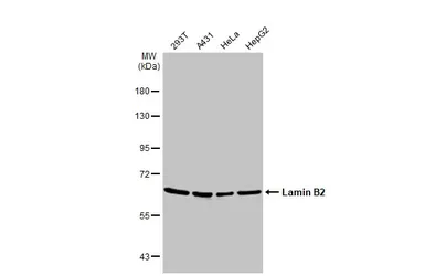 Anti-Lamin B2 antibody [N3C2], Internal used in Western Blot (WB). GTX109894
