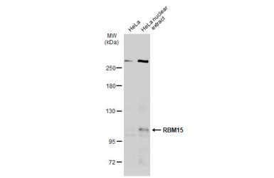 Anti-RBM15 antibody [N1N3] used in Western Blot (WB). GTX109899