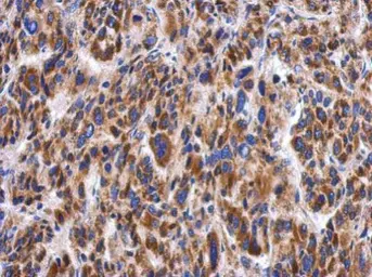 Anti-Myotilin antibody used in IHC (Paraffin sections) (IHC-P). GTX109905