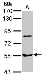 Anti-Myotilin antibody used in Western Blot (WB). GTX109905