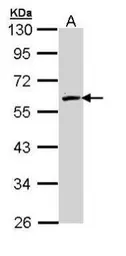Anti-FMO2 antibody [N1C2] used in Western Blot (WB). GTX109907