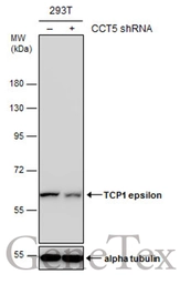 Anti-TCP1 epsilon antibody [N1N3] used in Western Blot (WB). GTX109908