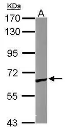 Anti-TCP1 epsilon antibody [N1N3] used in Western Blot (WB). GTX109908