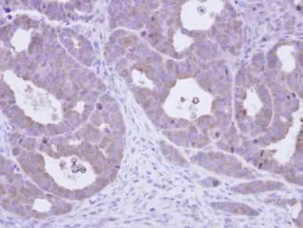 Anti-TCP1 epsilon antibody [N1N3] used in IHC (Paraffin sections) (IHC-P). GTX109908