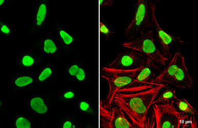 Anti-Ku80 antibody [N3C2], Internal used in Immunocytochemistry/ Immunofluorescence (ICC/IF). GTX109935