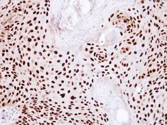 Anti-Ku80 antibody [N3C2], Internal used in IHC (Paraffin sections) (IHC-P). GTX109935