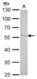 Anti-Pancreatic Lipase antibody [N1C1] used in Western Blot (WB). GTX109936