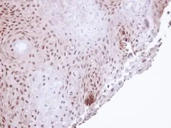 Anti-POLH antibody [N1N3] used in IHC (Paraffin sections) (IHC-P). GTX109938