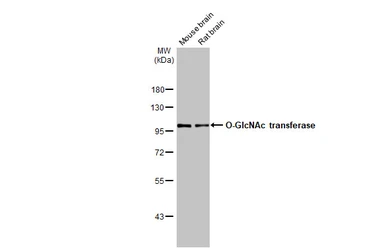 Anti-O-GlcNAc transferase antibody used in Western Blot (WB). GTX109939