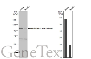 Anti-O-GlcNAc transferase antibody used in Western Blot (WB). GTX109939