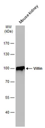 Anti-Villin antibody used in Western Blot (WB). GTX109940