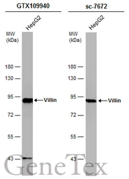 Anti-Villin antibody used in Western Blot (WB). GTX109940