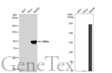 Anti-Villin antibody used in Western Blot (WB). GTX109940