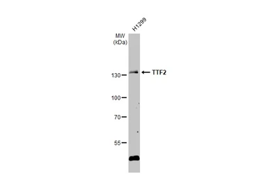 Anti-TTF2 antibody used in Western Blot (WB). GTX109947
